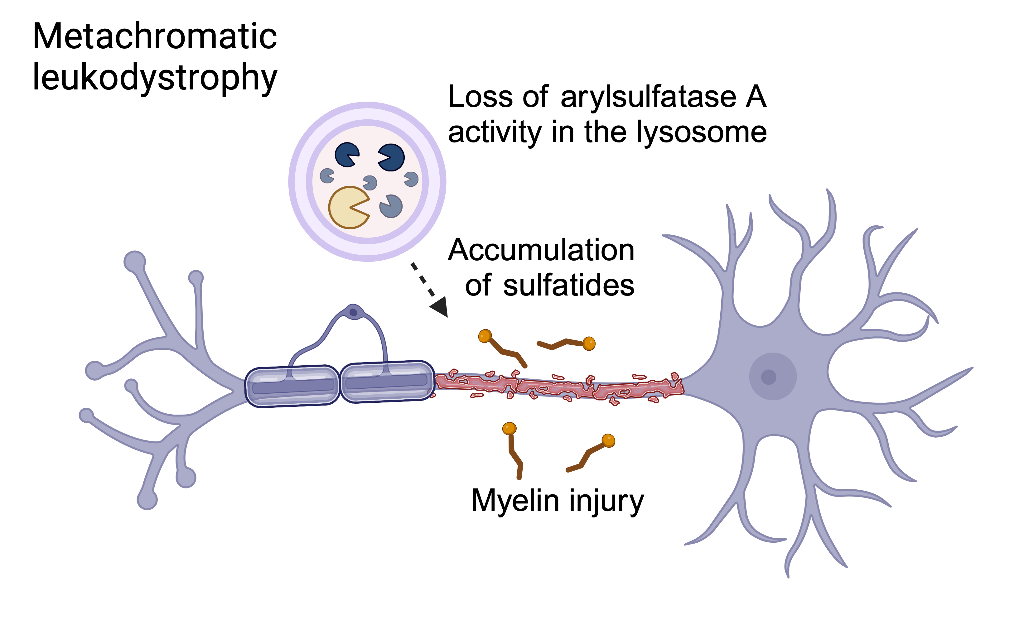 MLD disease mechanism